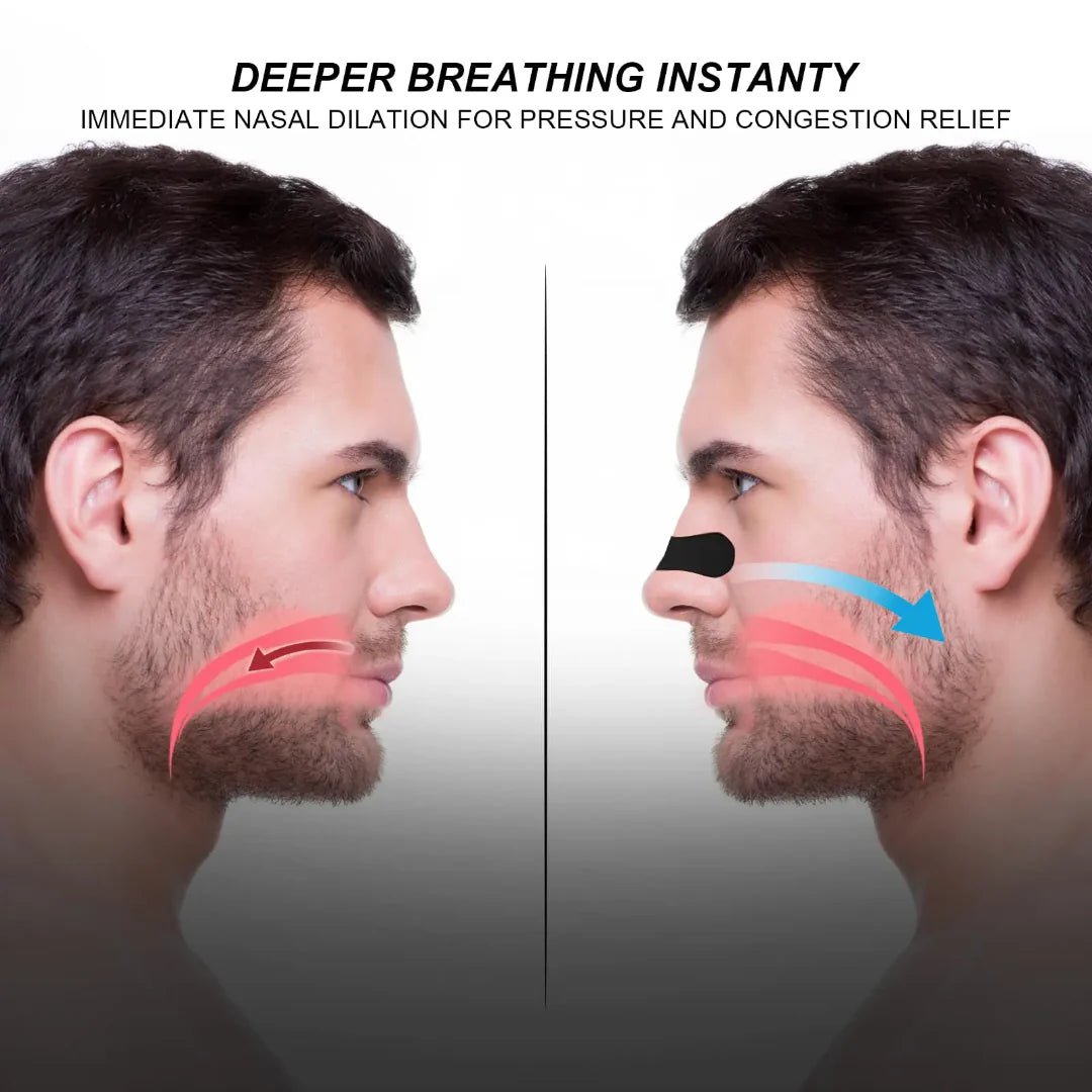 Tape nasal strips - Otloubnow