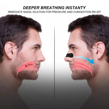 Tape nasal strips - Otloubnow